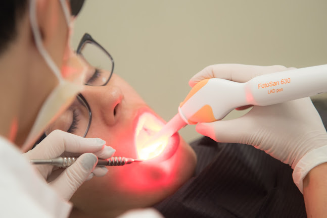 Dentalni tretman u ordinaciji